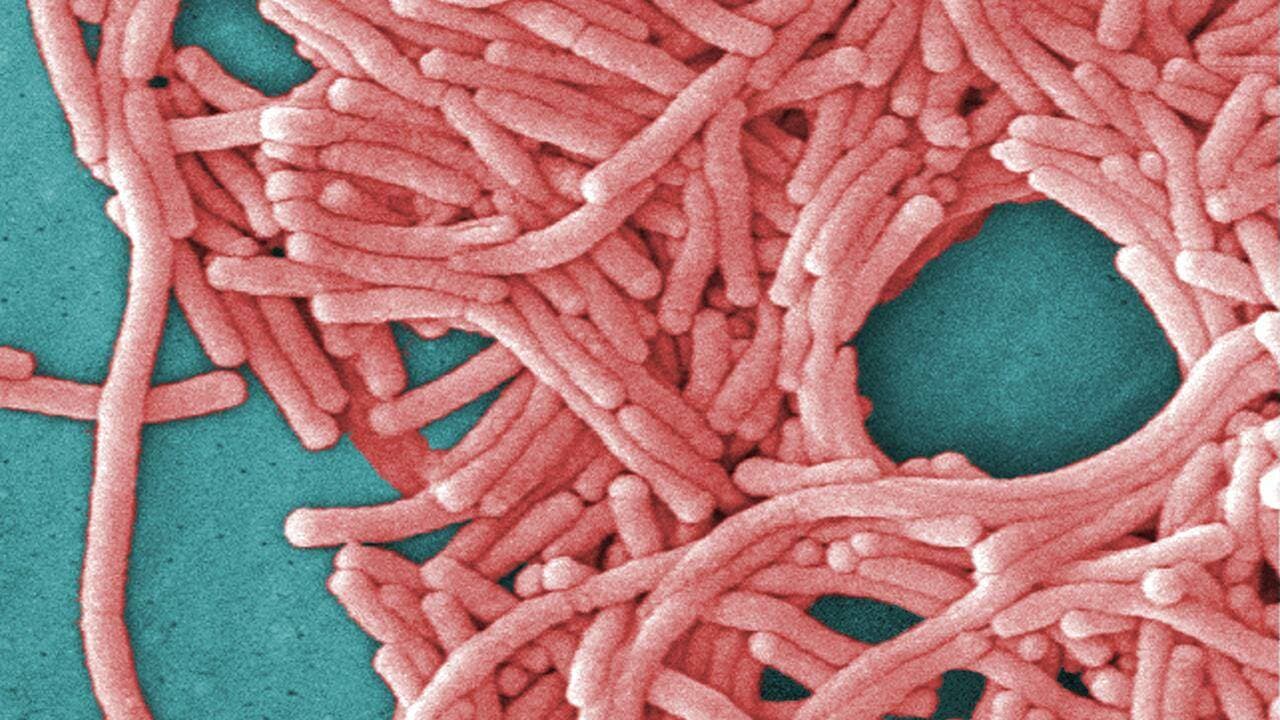 Legionnaires' disease is caused by infection with Legionella bacteria and can cause severe illness. (AP PHOTO)